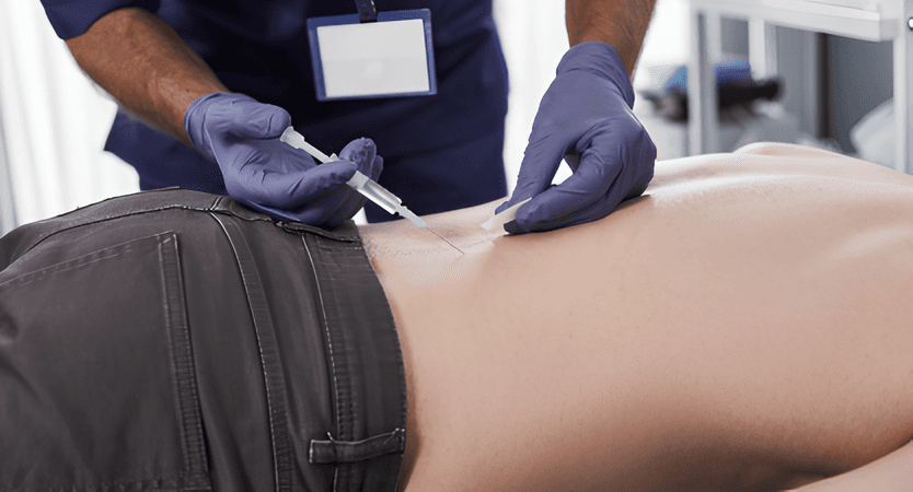 Infiltrații cu antiinflamatoare steroidiene